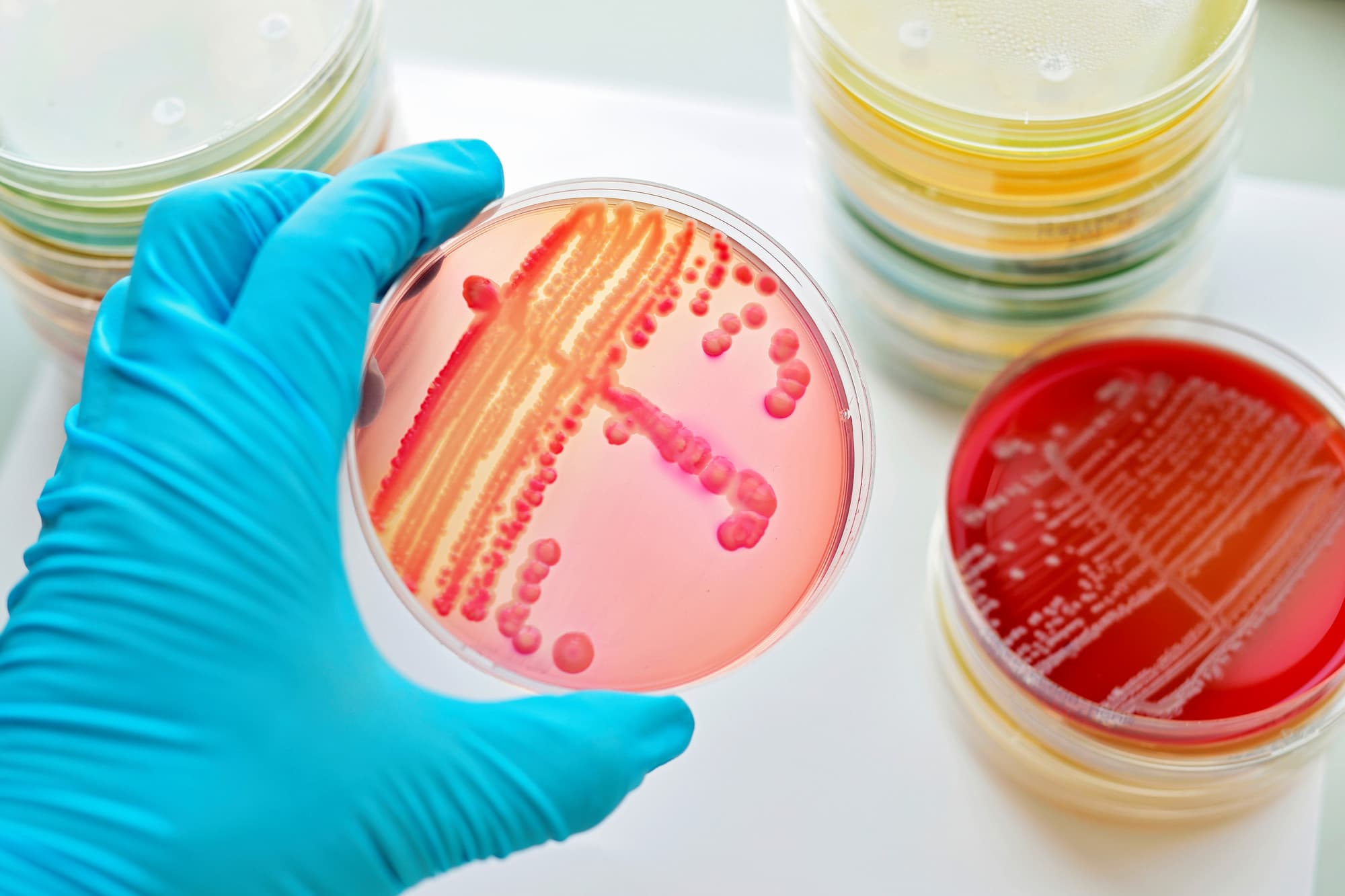 Dreifach-Impfung: Tetanus-Diphtherie-Pertussis – Hausärztliche Praxis
