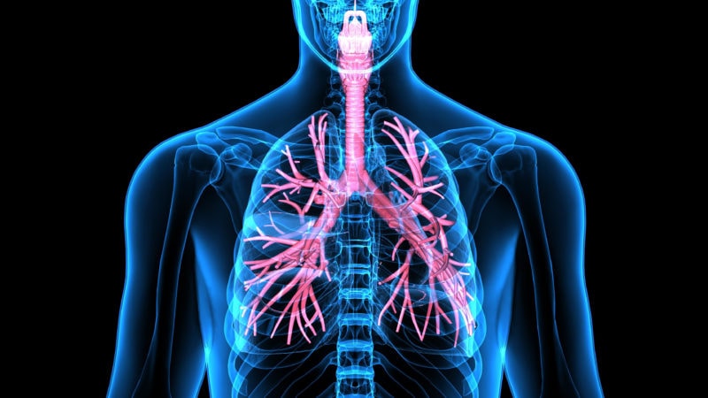 Bisher gab es für die Bronchiektasen-Erkrankung keine zugelassene Therapie und bis vor kurzem auch keine Leitlinie. Nun gibt es Hoffnung für bis zu drei Millionen Betroffene in Europa: Die Arzneimittelbehörde EMA hat mit Brensocatib dem ersten zielgerichteten Medikament die Zulassung erteilt.