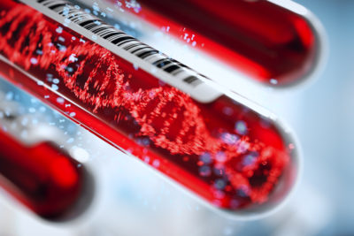 Mit einem Medienbericht über ihren Bluttest zur Früherkennung von Brustkrebs haben Forscher des Uniklinikums Heidelberg für Aufsehen gesorgt. Für ihr Vorgehen ernteten sie heftige Kritik - jetzt reagiert die Uniklinik.