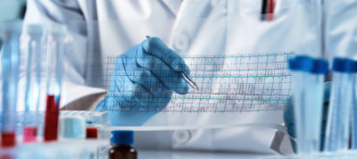 genetic engineering reading the structure chart with the results of the test / doctor analyzing DNA sequence results analysis graph