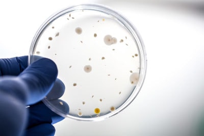 Gegen Gonorrhö gibt es kaum noch wirksame Antibiotika-Stämme, warnt das Robert-Koch-Institut.