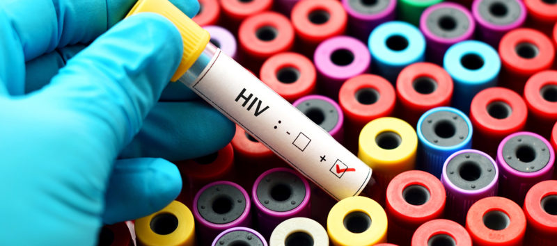 Ein Rückgang der HIV-Neuinfektionen könne nur dann erreicht werden, wenn sowohl Präventionsangebote als auch HIV-Testung eine bestimmte Personengruppe besser erreichen. Das bilanziert das Robert Koch-Institut in seinem HIV-Jahresbericht.