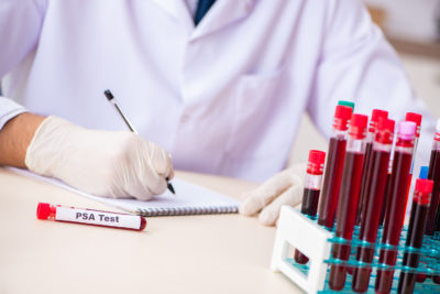 Untersuchungen zur Früherkennung von Prostatakrebs, insbesondere das PSA-Screening, sind hoch umstritten. Nun bilanziert auch das IQWiG: Ein PSA-Screening in der GKV würde mehr schaden als nutzen. PLUS: Tipps für die Beratung im Praxisalltag.