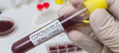 Deutscher und Bayerischer Hausärzteverband mahnen einen Strategiewechsel bei Corona-Tests an: Tests "im großen Stil" seien eine "unendliche Ressourcenverschwendung". Die Empfehlungen des RKI lauten jedoch (noch) anders.