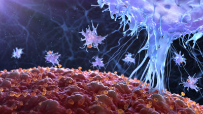 Auch wenn die Immuntherapie große Fortschritte bei der Krebsbehandlung gebracht hat, sprechen nicht alle Patienten auf eine solche Therapie an und Off-target Effekte oder Nebenwirkungen treten überall auf. Auch um Autoimmunkomplikationen zu vermeiden, sind prädiktive Biomarker wie der BMI wichtig.