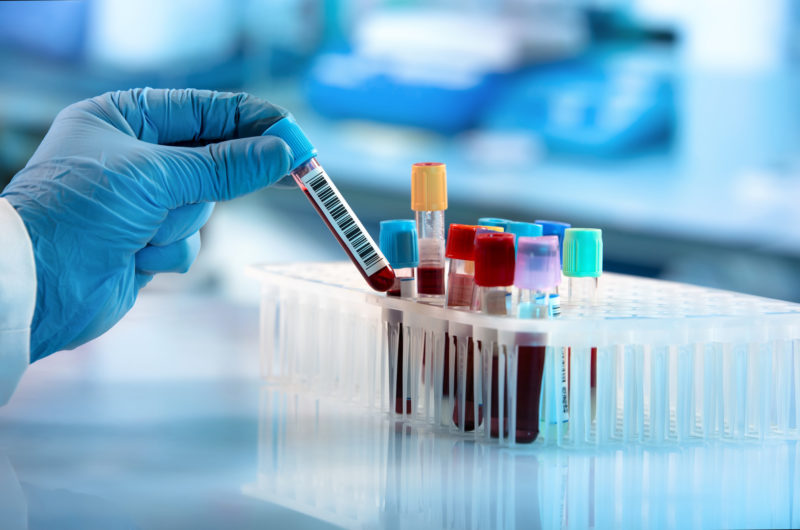 Die in Europa gemeldeten Fälle von Gonorrhö und Syphilis haben den höchsten Wert seit Jahren erreicht. Besonders besorgniserregend: Zwischen 2023 und 2024 hat sich die Zahl der von der Mutter auf das Kind übertragenen Syphilis-Fälle nahezu verdoppelt.