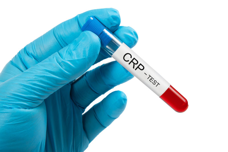 Wann Sinkt Crp Nach Antibiotika www.hausaerztlichepraxis.digital