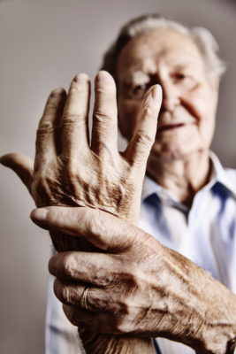 Rheuma-Erkrankungen sollten möglichst frühzeitig diagnostiziert und behandelt werden. Womit man eine Erstlinientherapie der rheumatoiden Arthritis (RA) am besten einleitet und wann und ob die Therapie wieder deeskaliert oder beendet werden kann, diskutierten Experten auf dem diesjährigen virtuellen Kongress der Europäische Liga gegen Rheuma (EULAR).