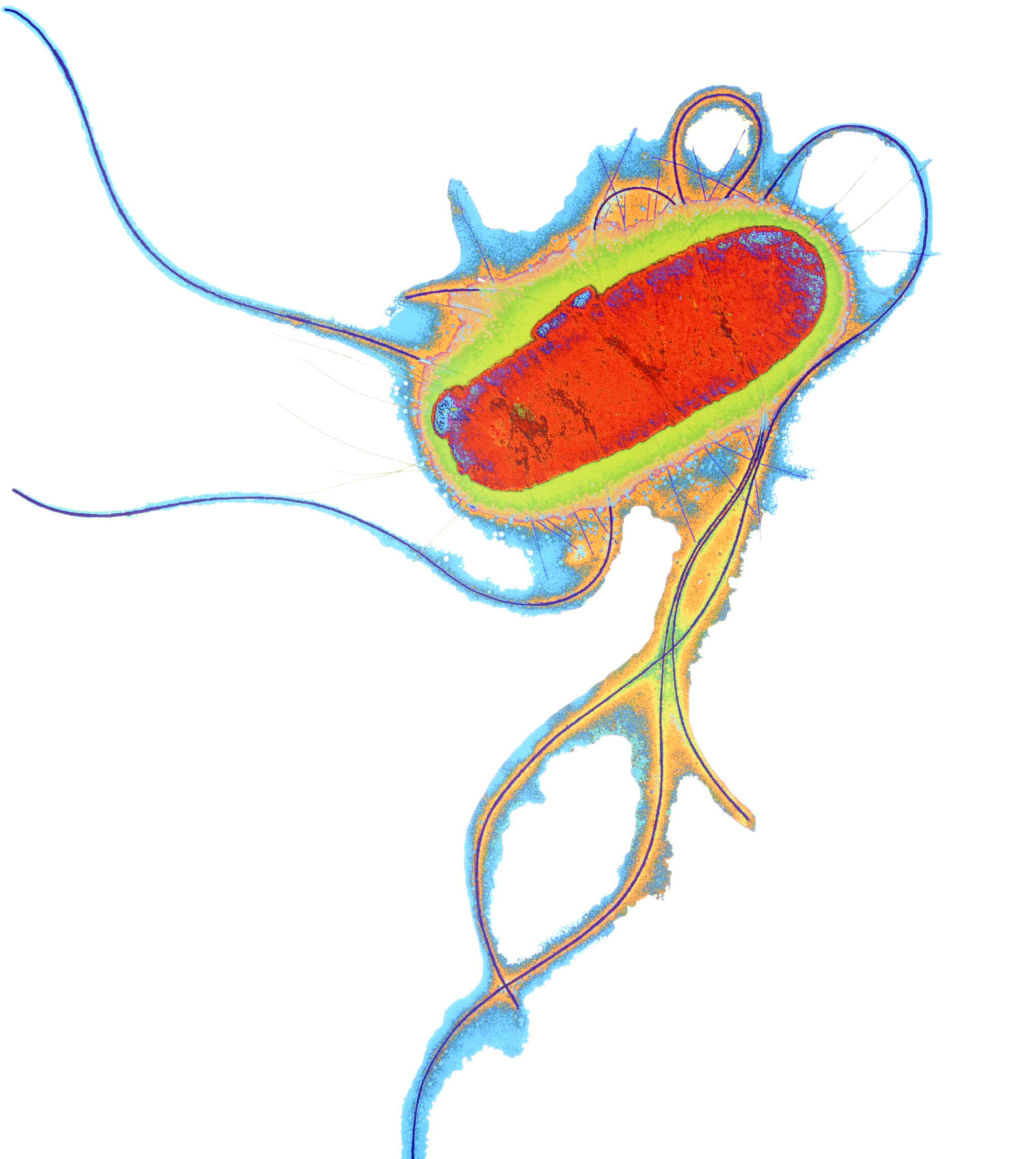 Enterobakterien wie Escherichia coli oder Klebsiella pneumoniae sind gefürchtete Krankenhauskeime, die schwereInfektionen in Darm und Harnwegen verursachen können.