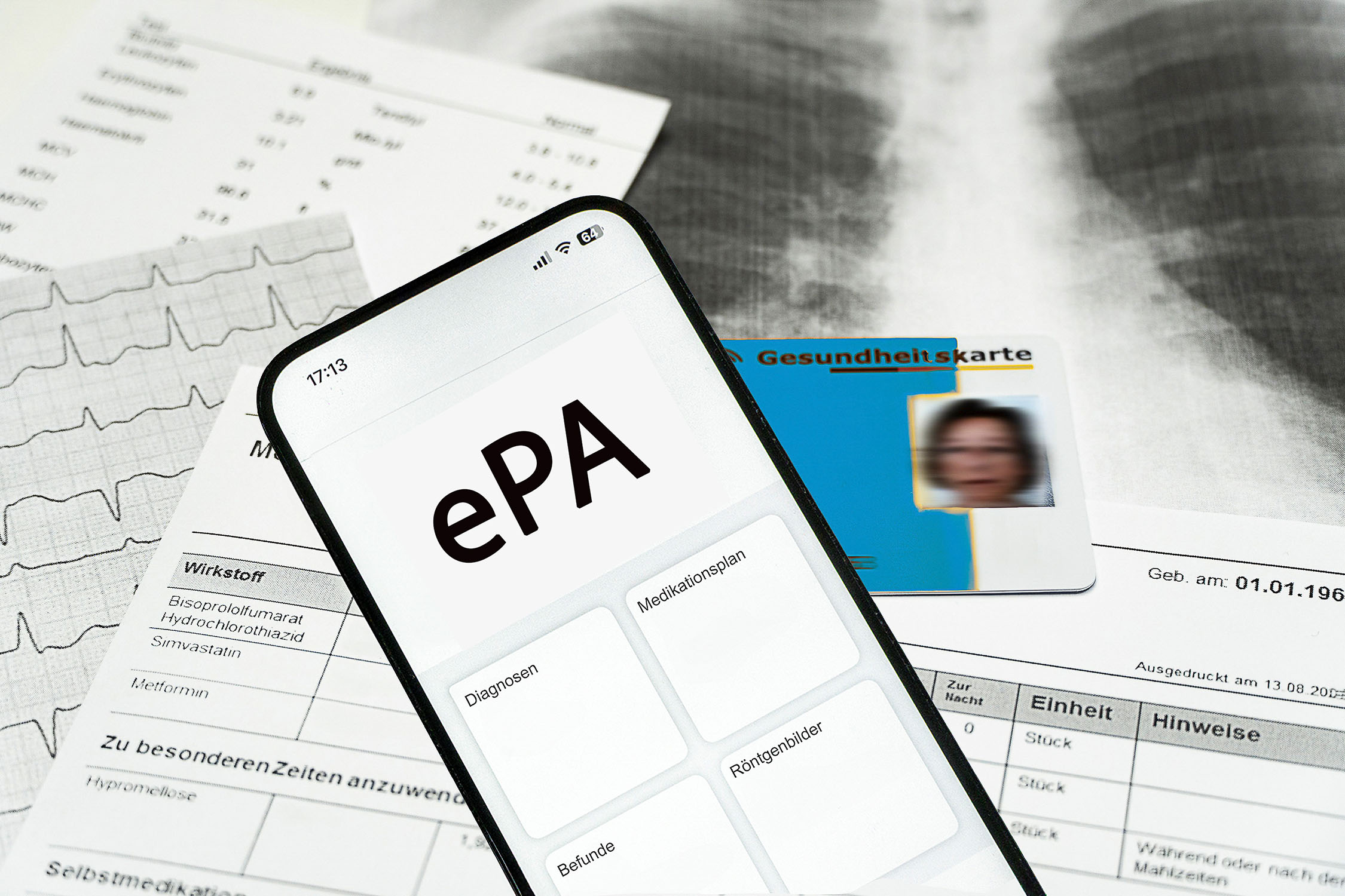 Am Dienstag hat der stufenweise Rollout der elektronischen Patientenakte begonnen. Doch Hacker zeigen Probleme mit der Sicherheit auf. Die Gematik schließt die Lücke vorerst - für Praxen sollte aber bis Juli eine endgültige Lösung gefunden werden.