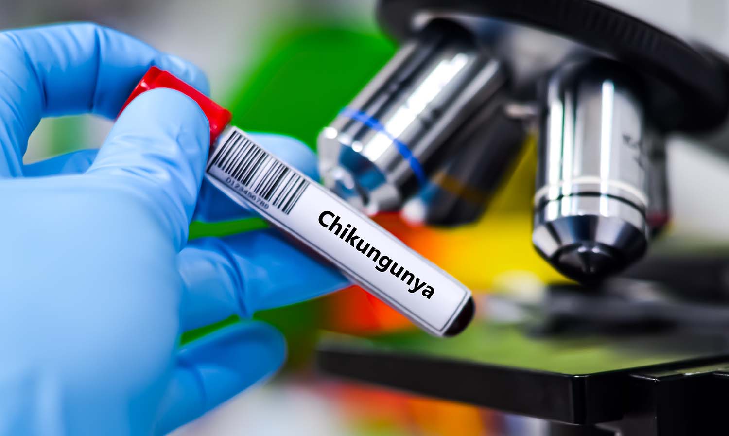 Nachdem der Gemeinsame Bundesausschuss die STIKO-Empfehlung zur Impfung gegen Chikungunya in die Schutzimpfungs-Richtlinie aufgenommen hat, gibt es von der KV Rheinland-Pfalz nun auch Abrechnungshinweise.